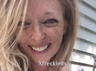 Xfreckledx